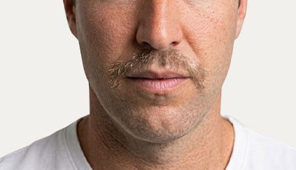 Image from eye and thin moustache.